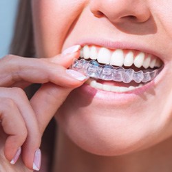 Woman putting in Invisalign