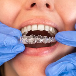 Woman getting Invisalign